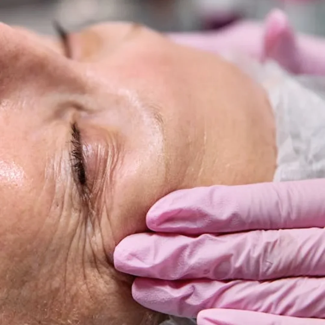 Anti Ageing Treatment in Pune