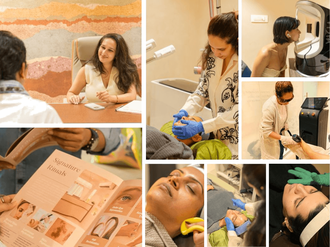 Acne Treatment Collage