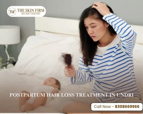 Postpartum hair loss treatment