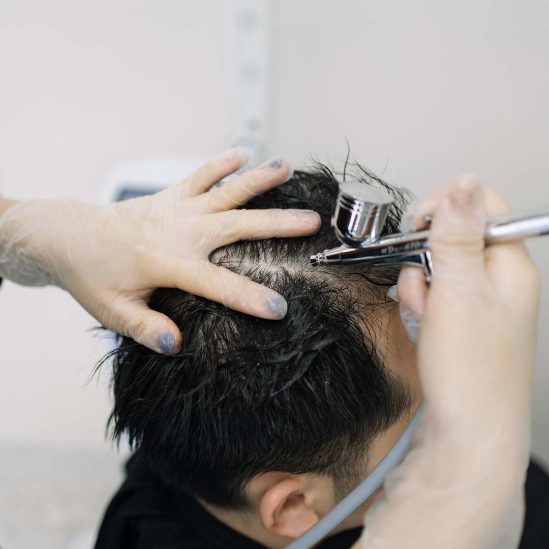 Hair Mesotherapy