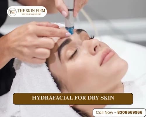 Hydrafacial for dry skin