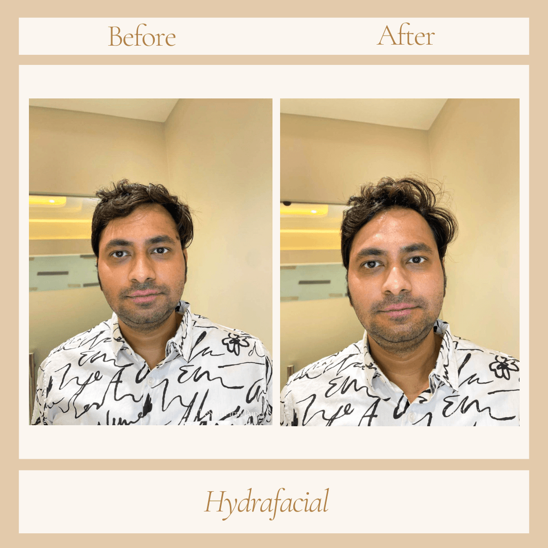 Treatment 11