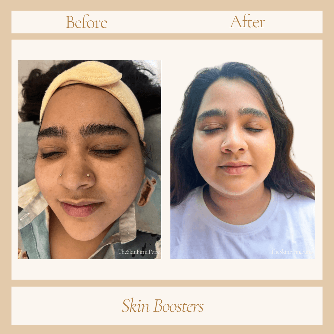 Treatment 8